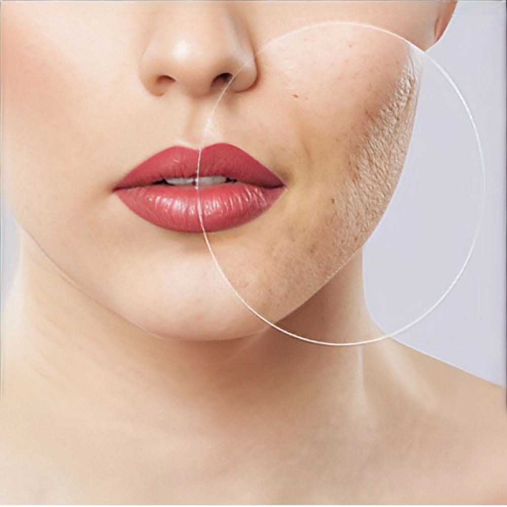 درمان جای جوش صورت خانگی