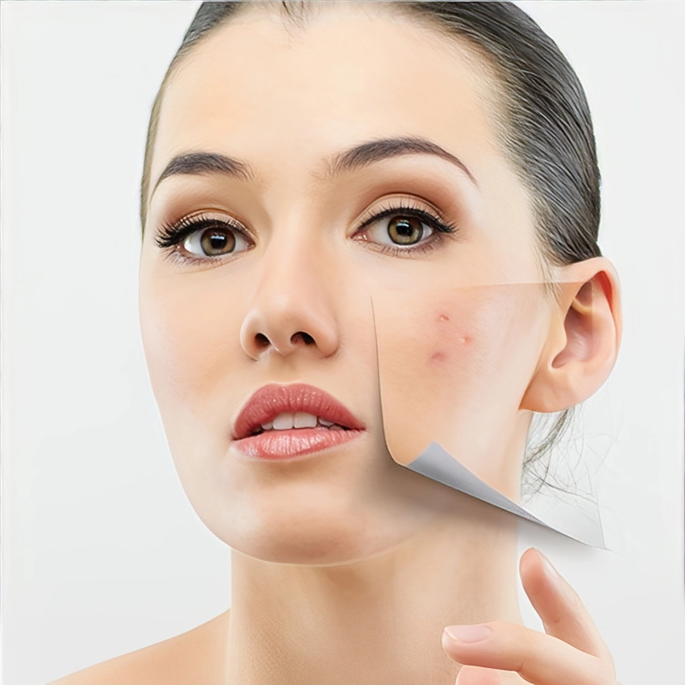 سابسیژن پوست چیست