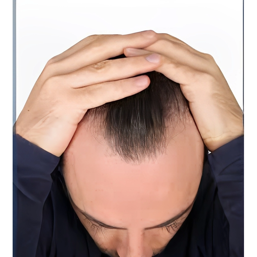 نحوه استفاده از کوکتل مو فیوژن