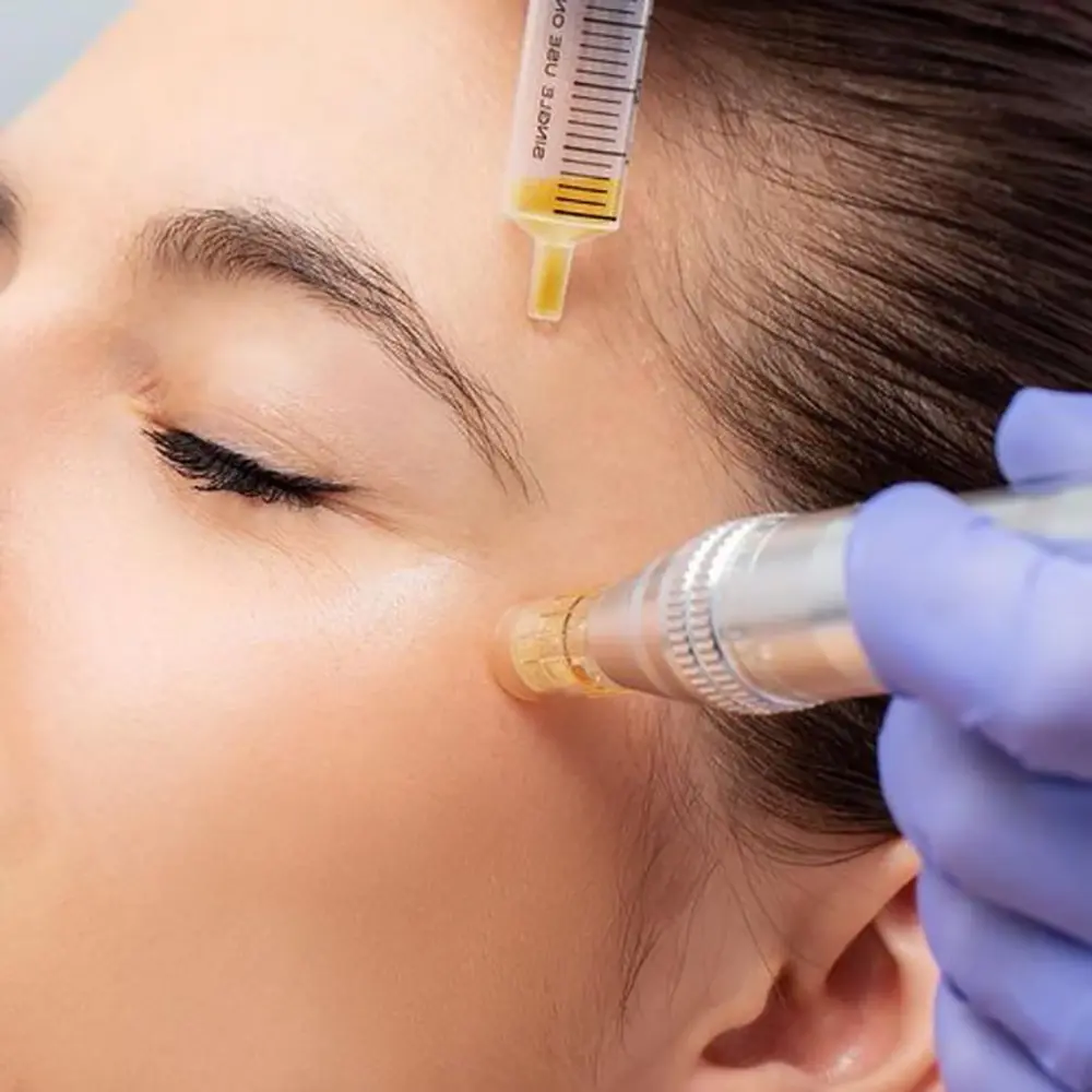 بهترین کوکتل میکرونیدلینگ