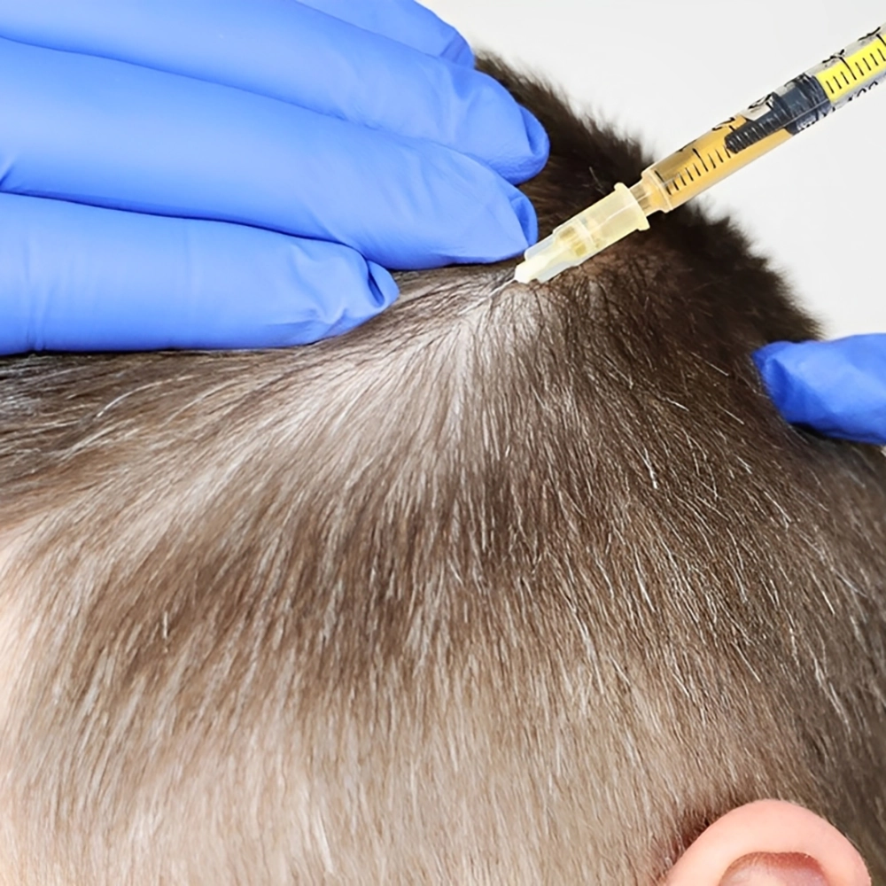 کوکتل مزوتراپی رویش مجدد مو