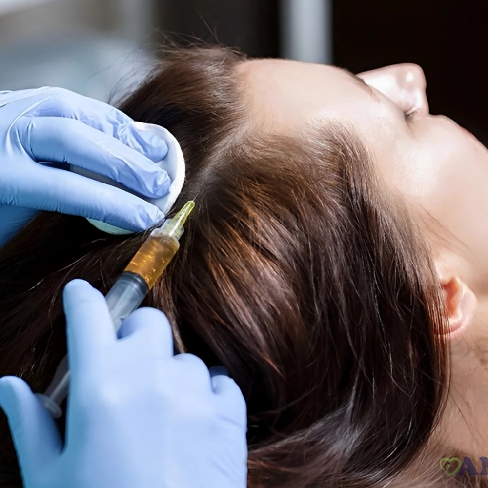 کاشت مو بهتر است یا مزوتراپی