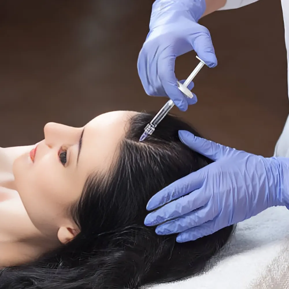 تاثیر پی آر پی بر ریزش موی ارثی