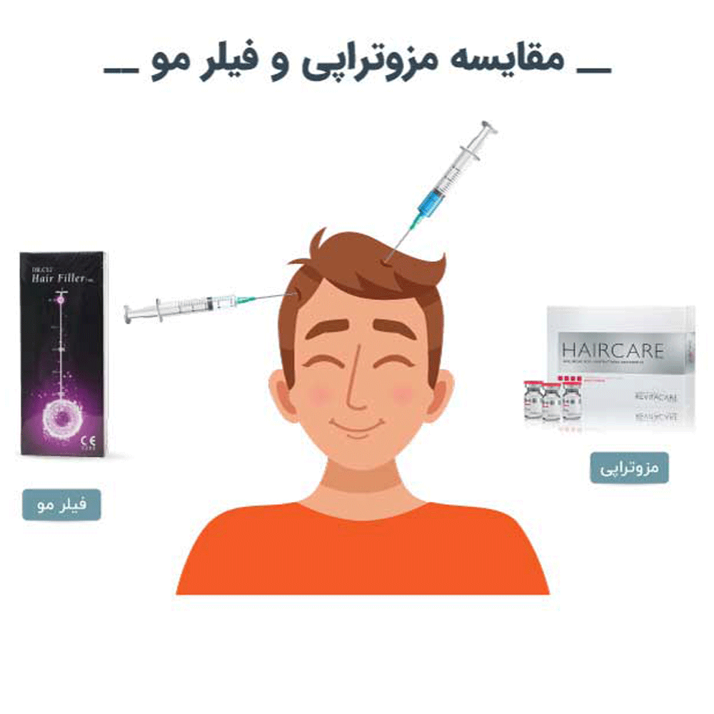 تفاوت هیرفیلر و مزوتراپی مو