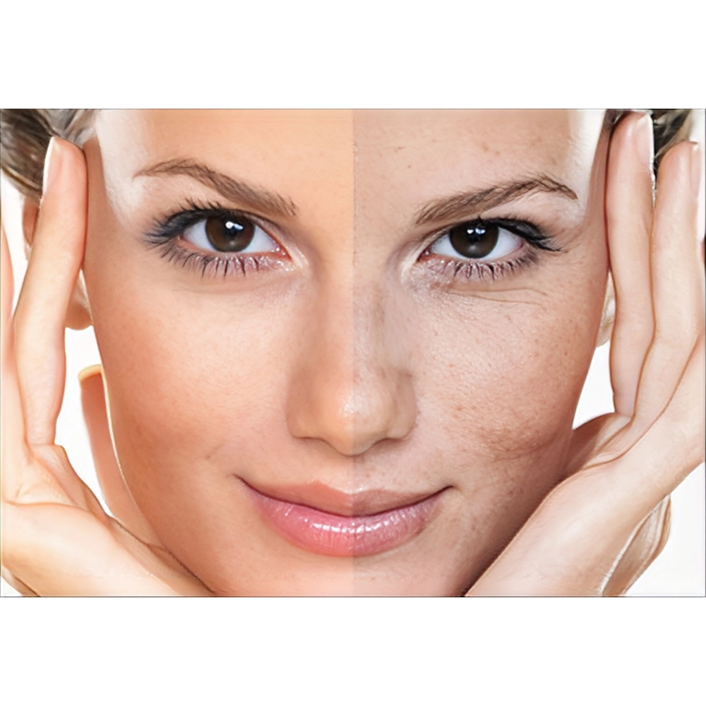 عوارض مزوتراپی صورت چیست