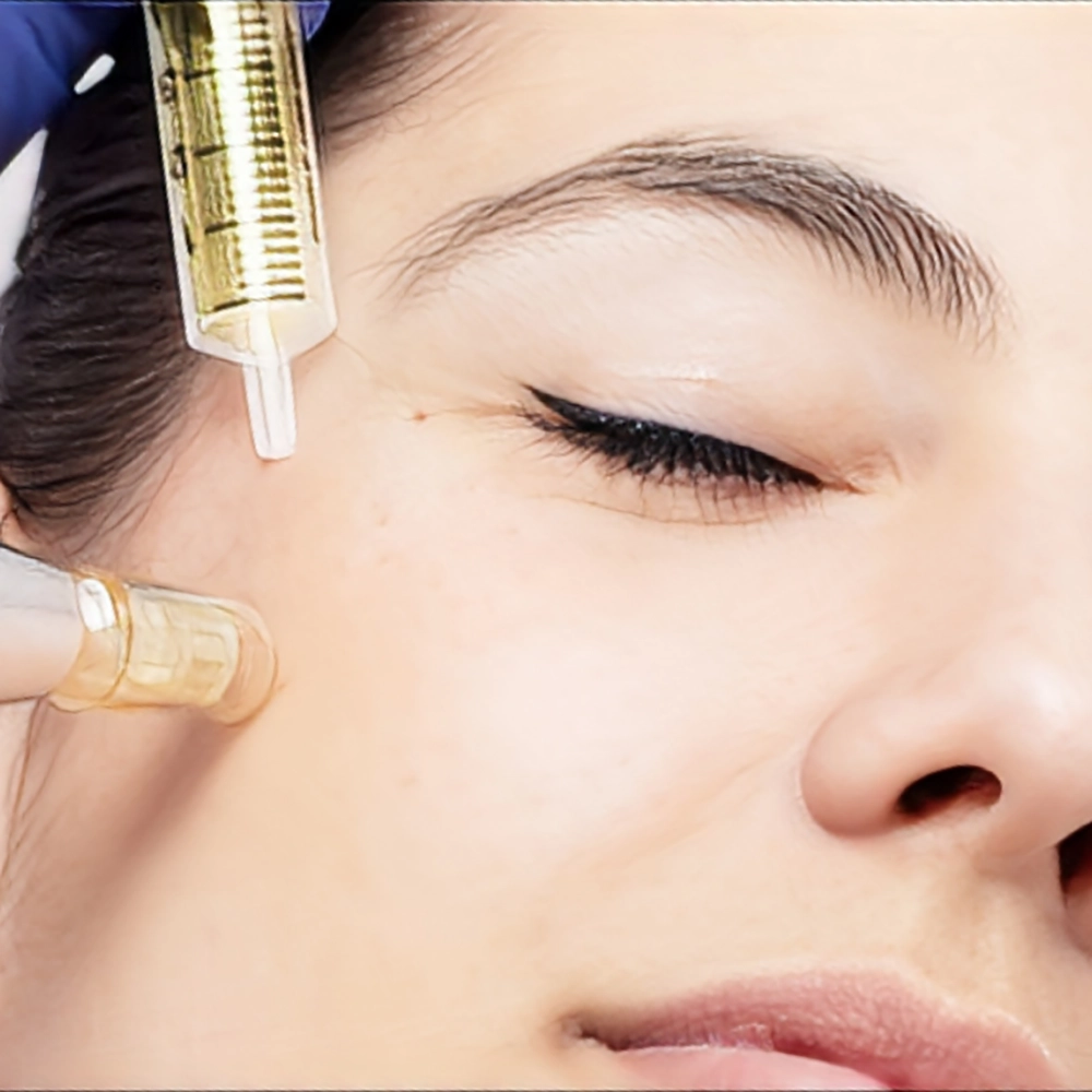 فرق مزوژل با مزوتراپی چیست