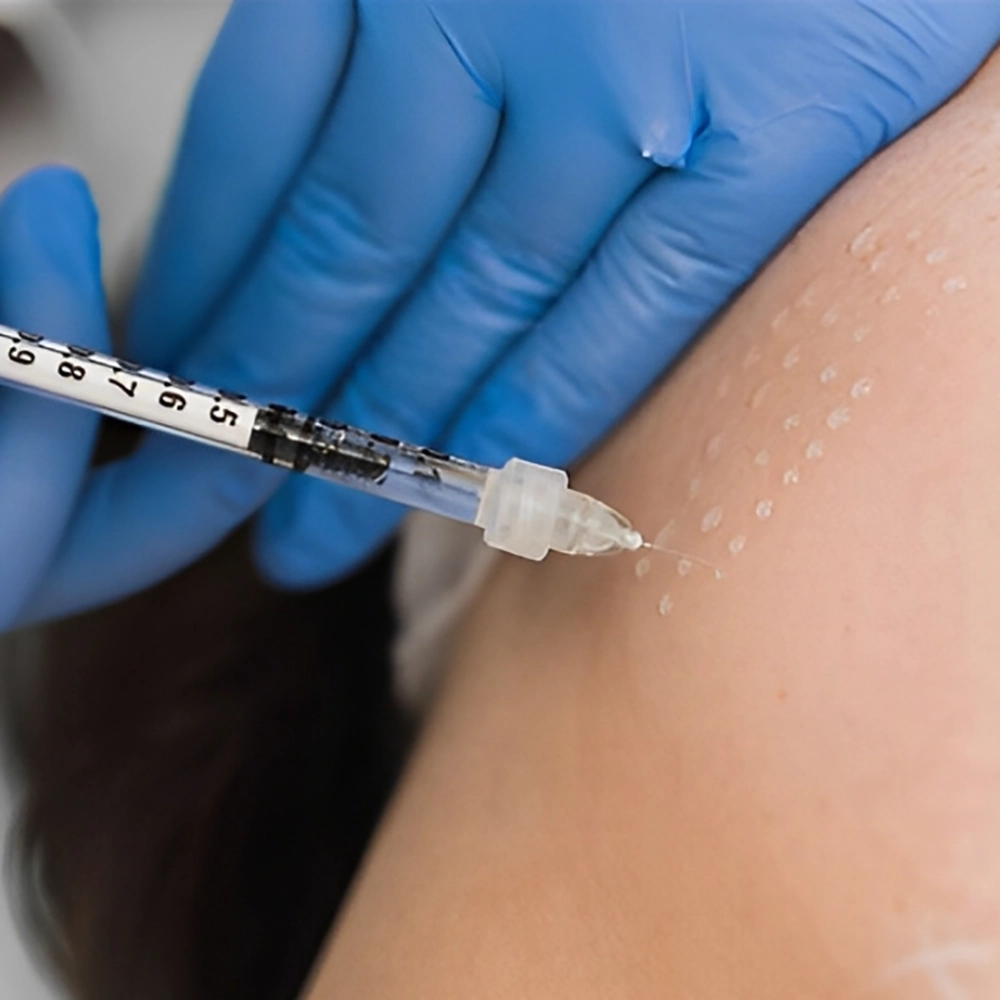 مزوتراپی صورت چیست