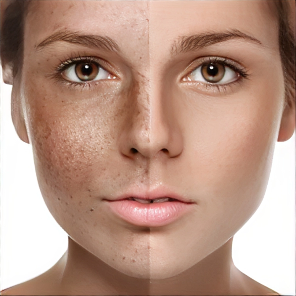 سریع ترین راه از بین بردن لک قهوه ای صورت