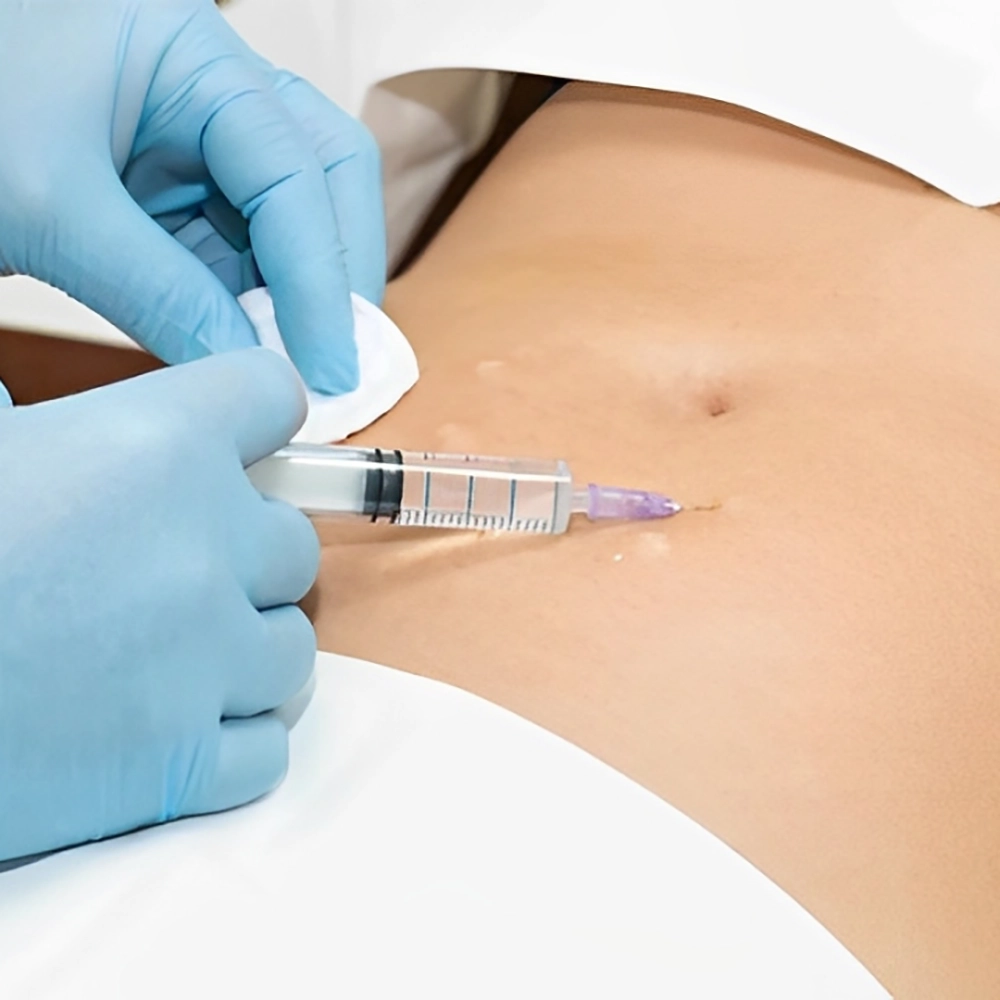 بهترین کوکتل مزوتراپی لاغری