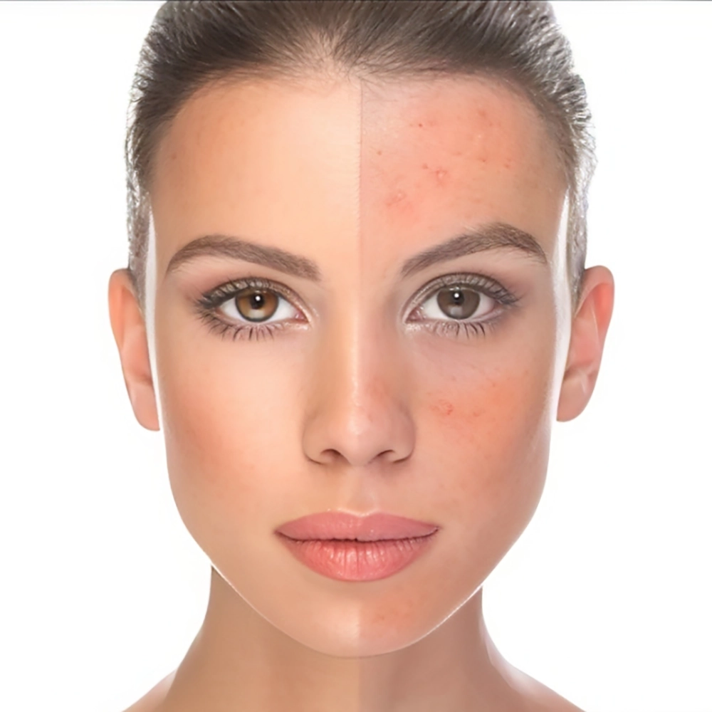 بهترین کوکتل مزوتراپی روشن کننده پوست چیست؟