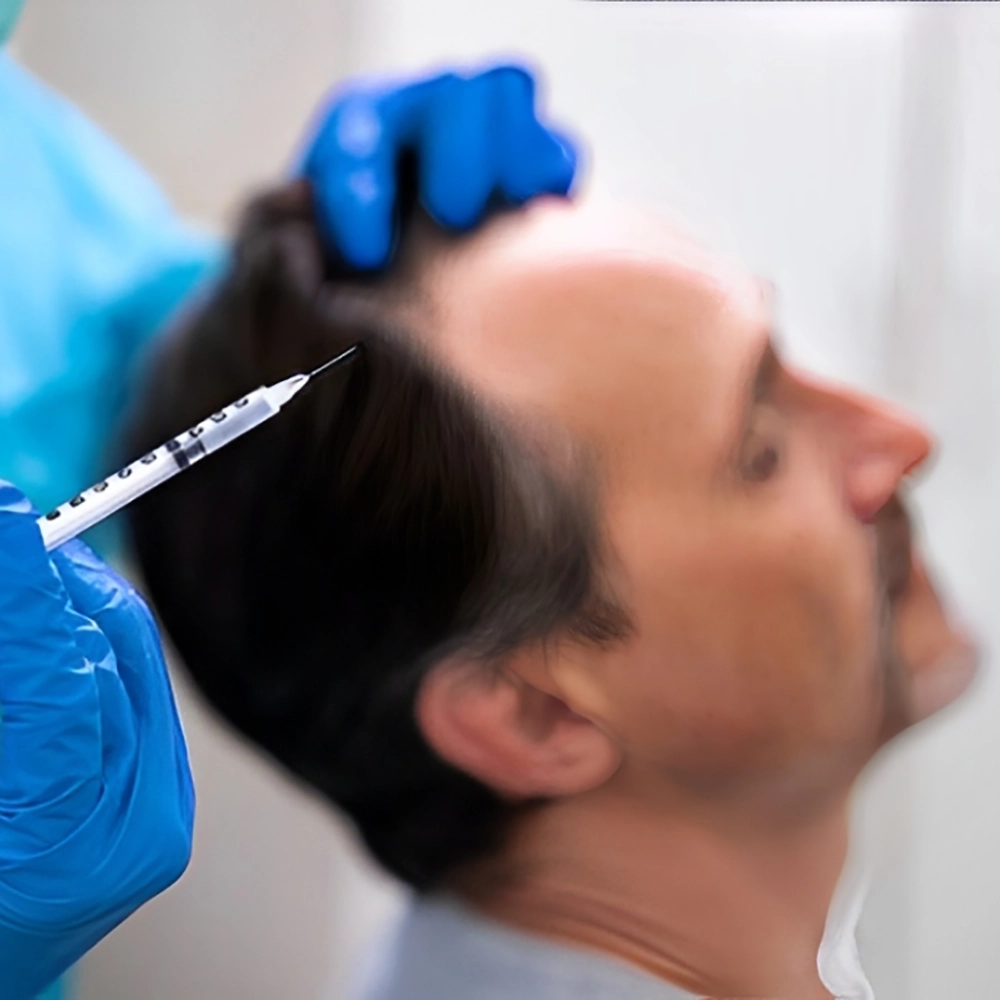 سن مناسب مزوتراپی مو