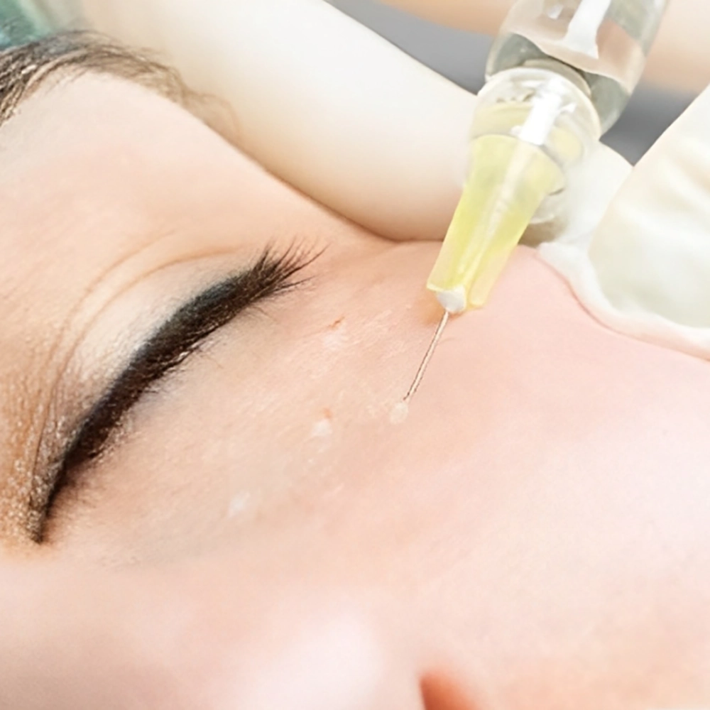 بهترین کوکتل مزوتراپی برای زیر چشم چیست؟