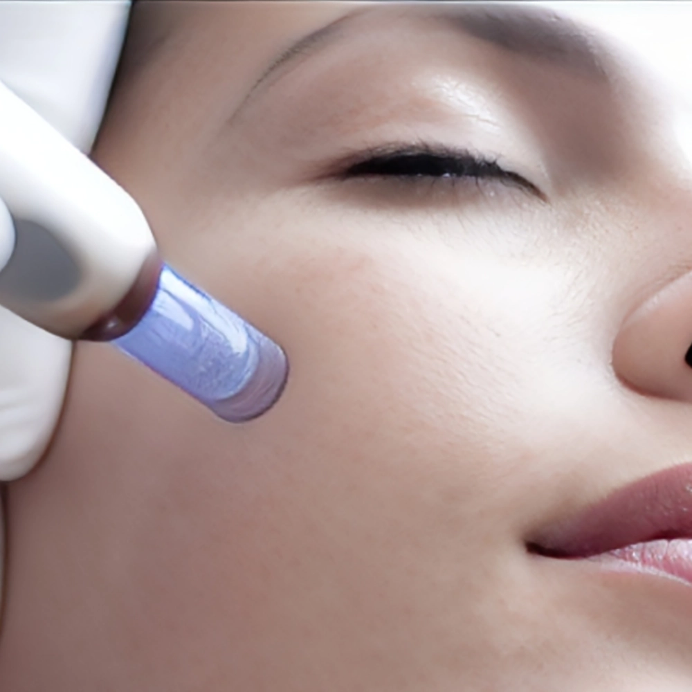 بهترین کوکتل مزوتراپی برای جای جوش چیست؟