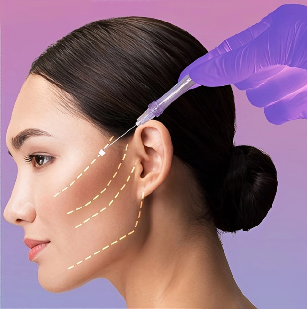 انواع روش های لیفت صورت