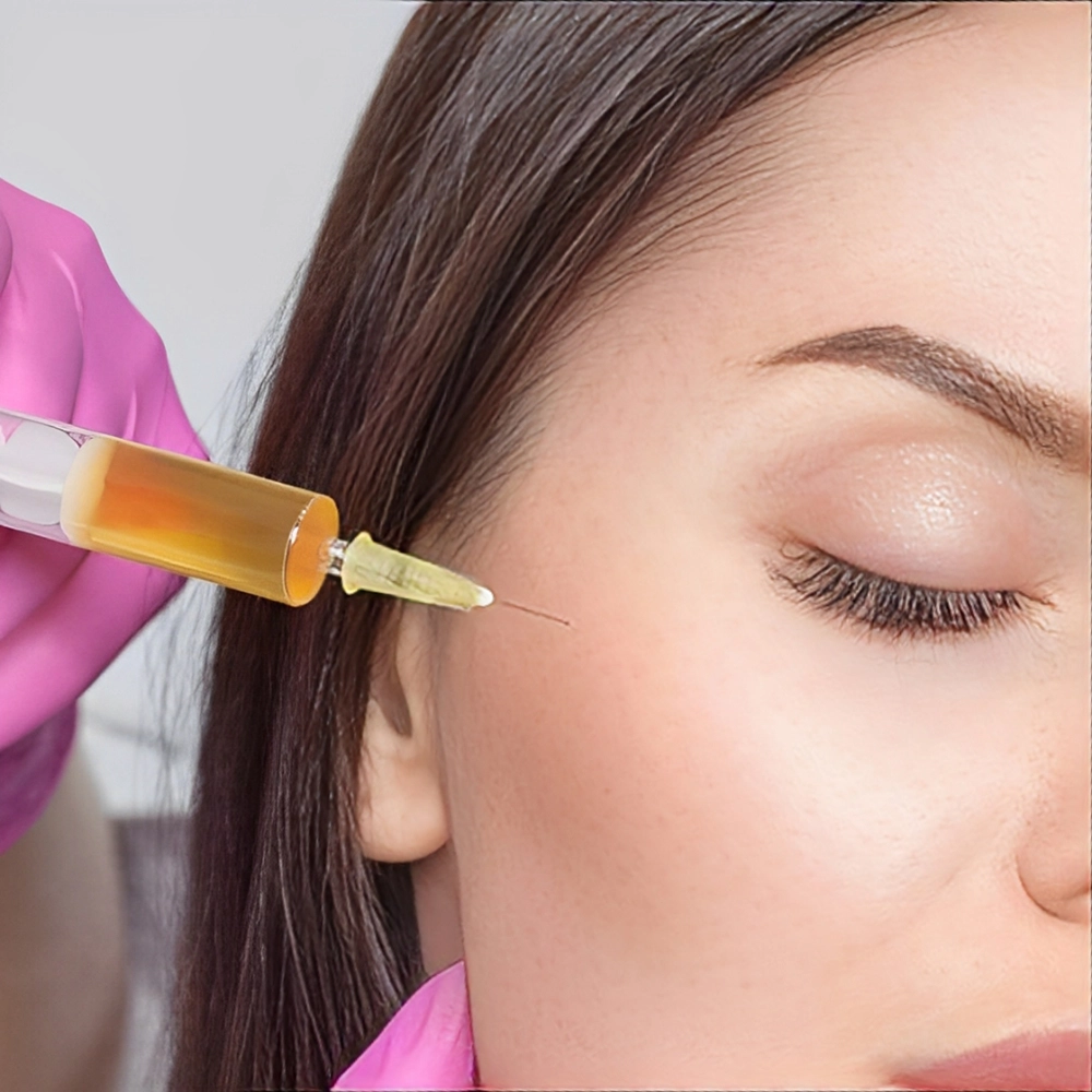 نحوه عملکرد پی ار پی