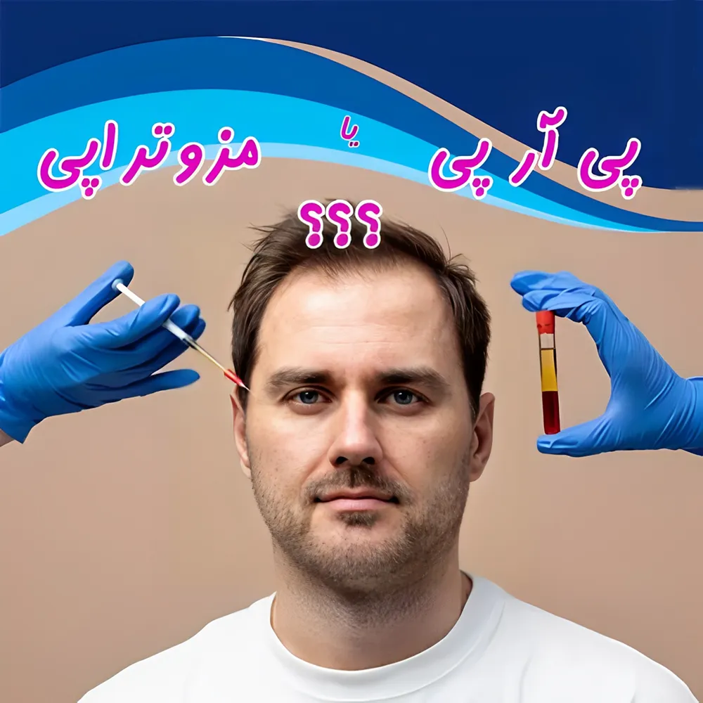 بعد از کاشت مو پی آر پی بهتر است یا مزوتراپی