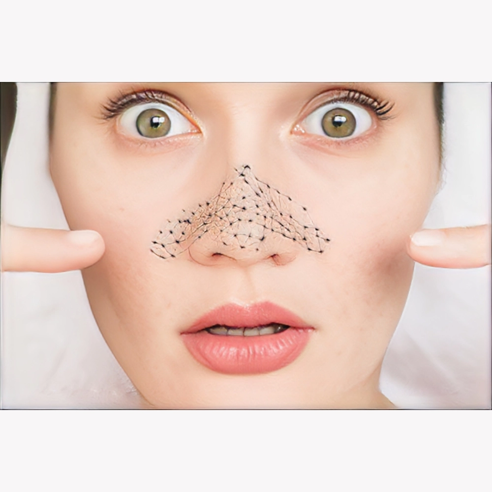 بهترین ماسک صورت برای جوش سر سیاه