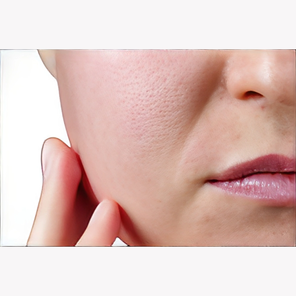 بهترین ماسک صورت برای بستن منافذ باز پوست