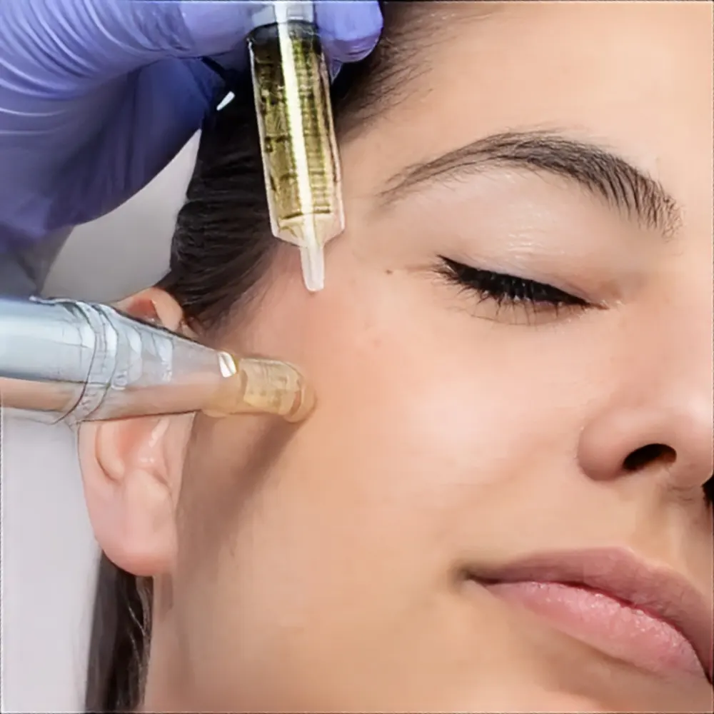 میکرونیدلینگ و مزوتراپی صورت چیست