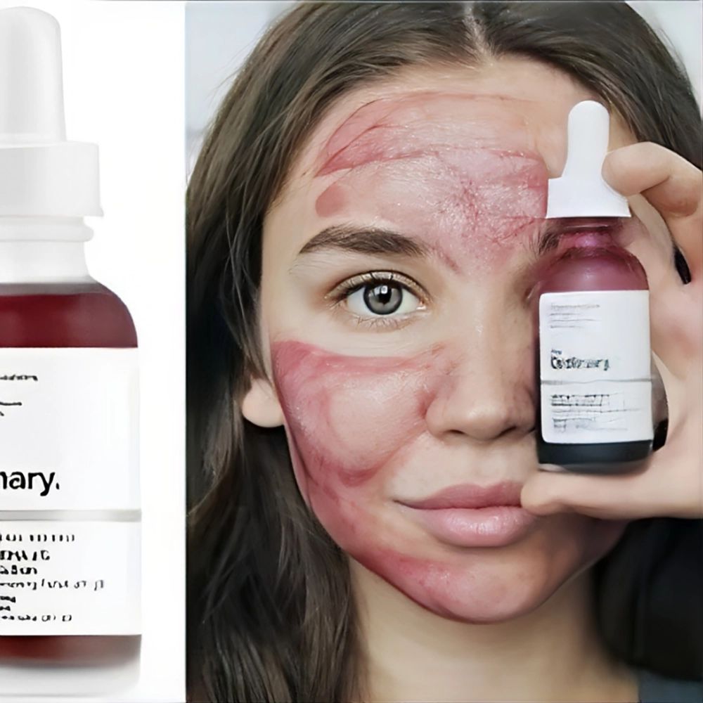 اسید های پوست AHA، BHA و PHA چیست؟