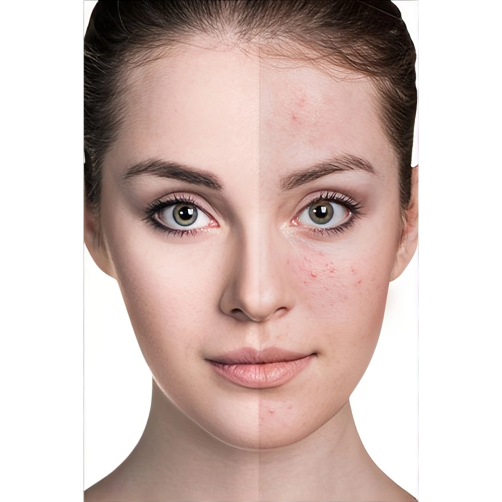 محصولات و روش‌ های موثر حل مشکل منافذ باز