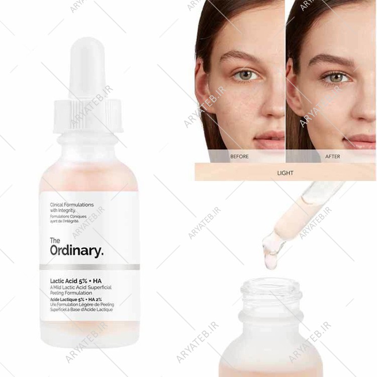 سرم لاکتیک اسید اوردینری